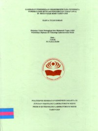 Karya Tulis Ilmiah Th. 2019 : Gambaran Pemeriksaan Mikroskopis Pada Penderita Tuberkulosis Setelah Pengobatan Tahap Awal Di RSUD Pasar Rebo Tahun 2018 (Teks Dan E_Book)