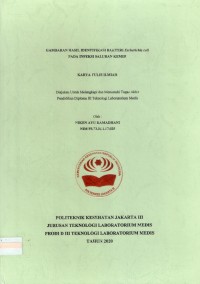 Karya Tulis Ilmiah Th.2020 : Gambaran Hasil Identifikasi Bakteri Escherichia coli Pada Infeksi Saluran Kemih (Teks Dan E_Book)