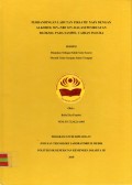 Skripsi Analis Th.2018 : Perbandingan Larutan Fiksatif Nafs Dengan Alkohol 96%-NBF 10% Dalam Pembuatan Bloksel Pada Sampel Cairan Pleura (Teks Dan E_Book)